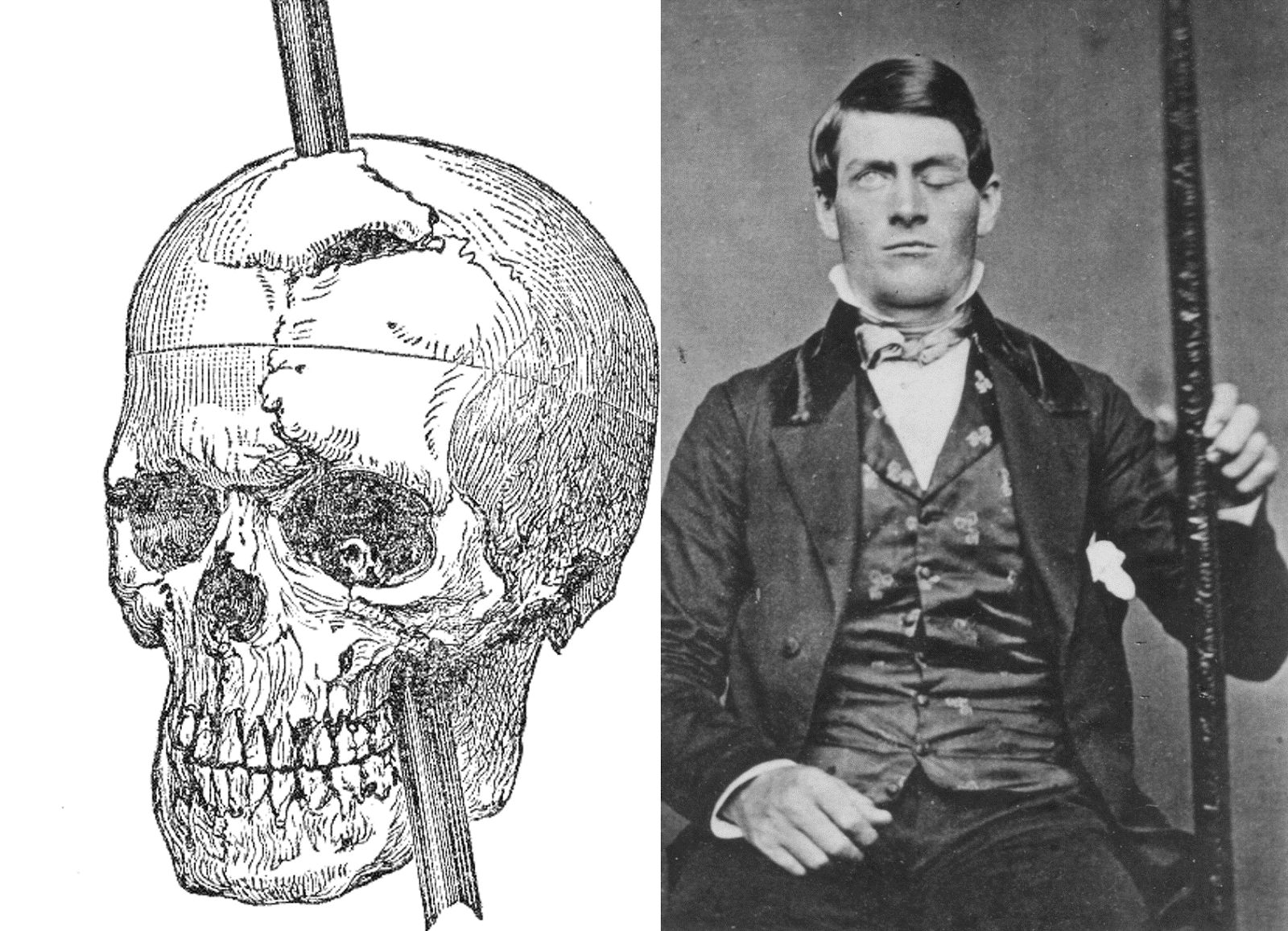 UX Design Comportemental, Phineas Gage